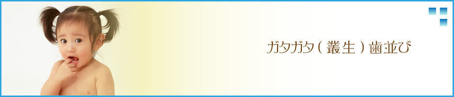 ガタガタ歯並び