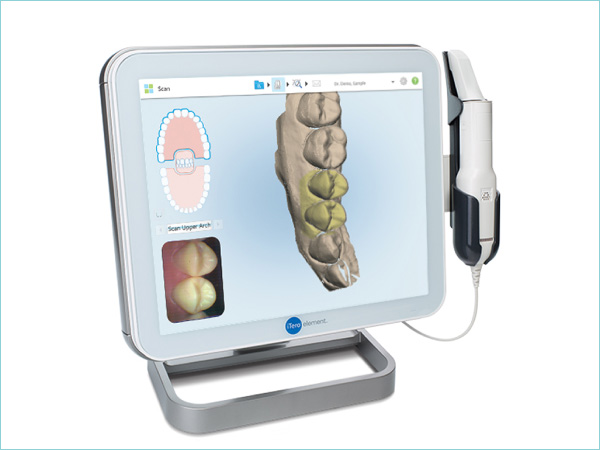 ３Ｄスキャニング機器iTero(アイテロ)
